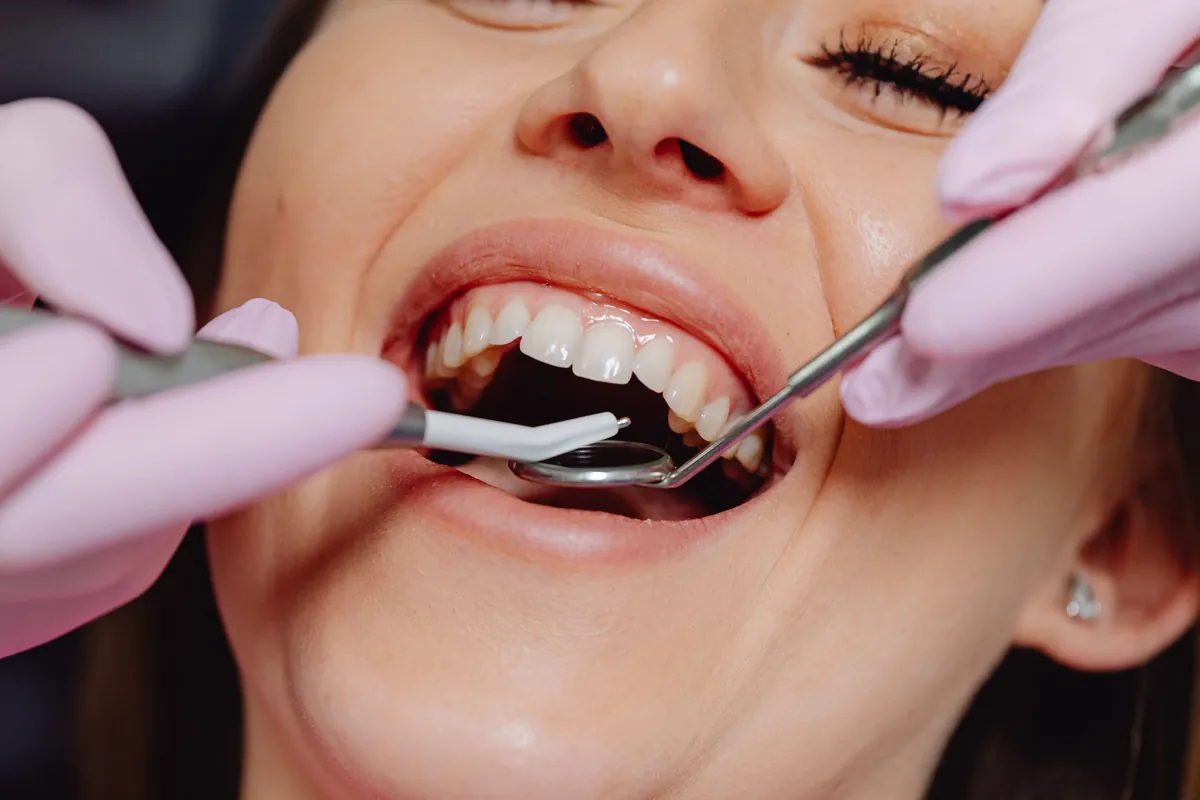 Close-up of a healthy, bright smile during a dental exam